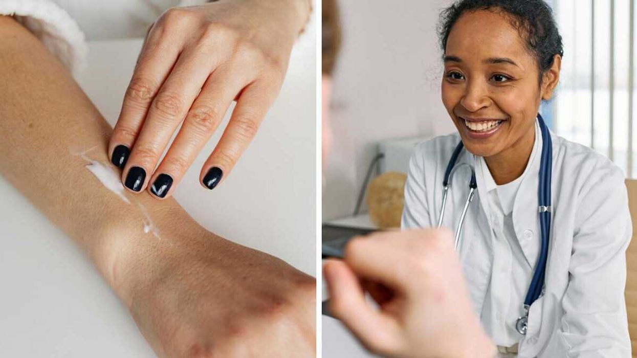 A hand applying cream to forearm. Right: Portrait of a doctor smiling.