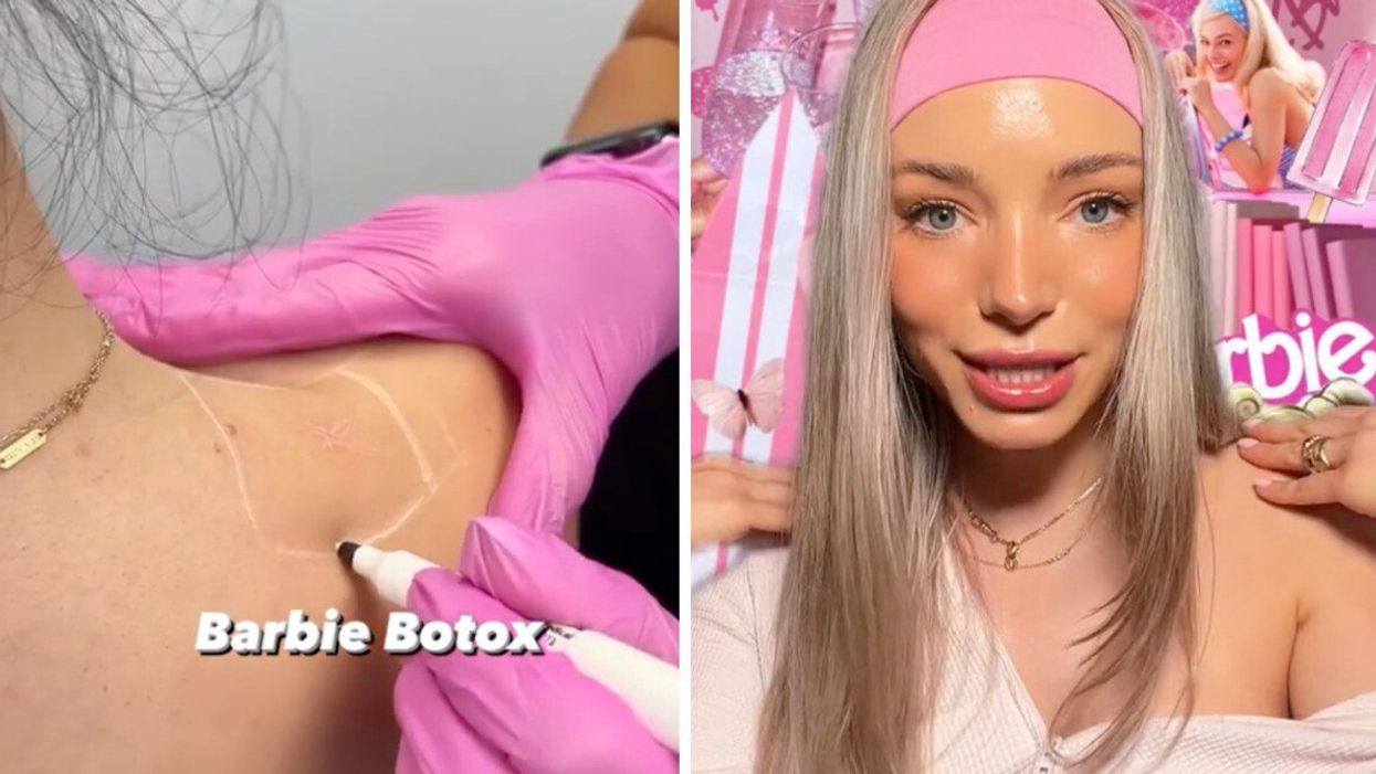 A patient getting a Barbie Botox injection. Right: A TikToker talking about Barbie Botox.
