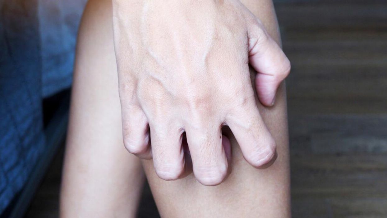 A person scratching.