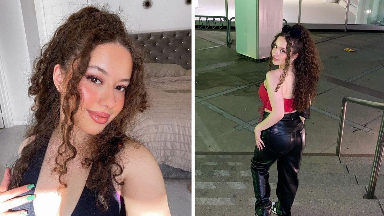 A Toronto Beauty TikToker Shared Her Body-Acne Journey & The Response Has Been Heartwarming