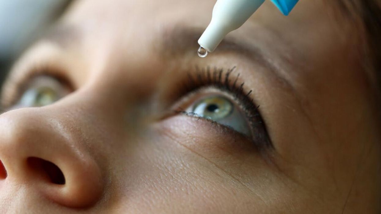 A woman putting eyedrops into her eye.