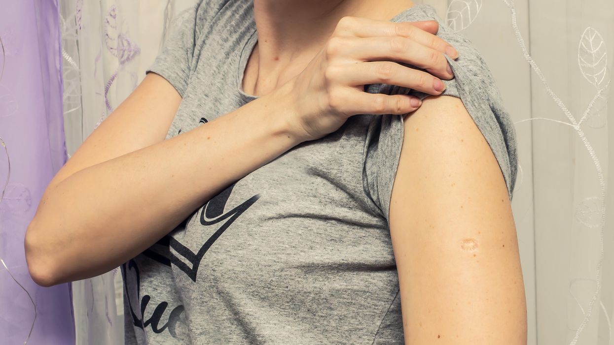 A woman showing her arm.