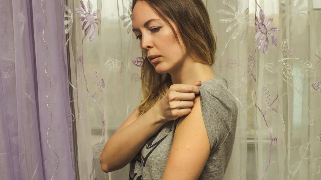 A woman shows a lesion on her arm.