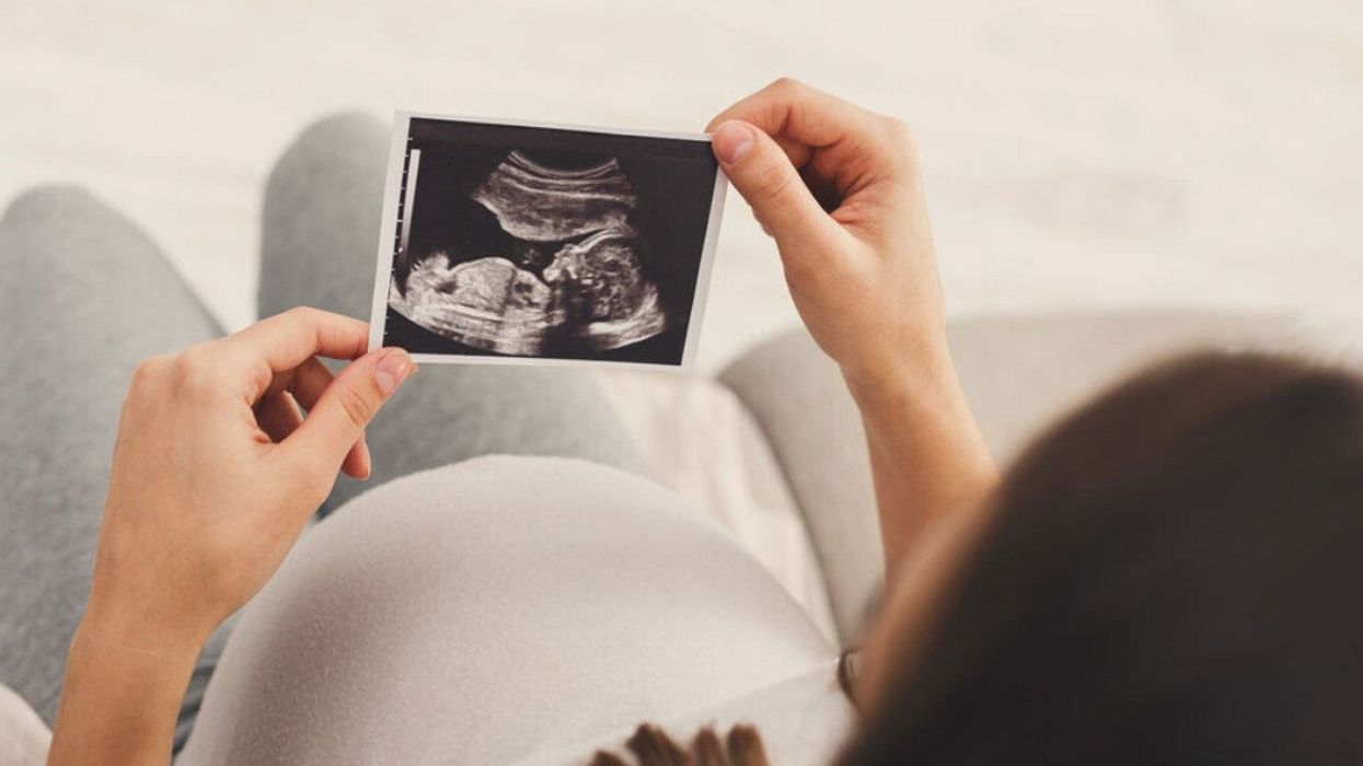 An expecting mother looking at an ultrasound picture.