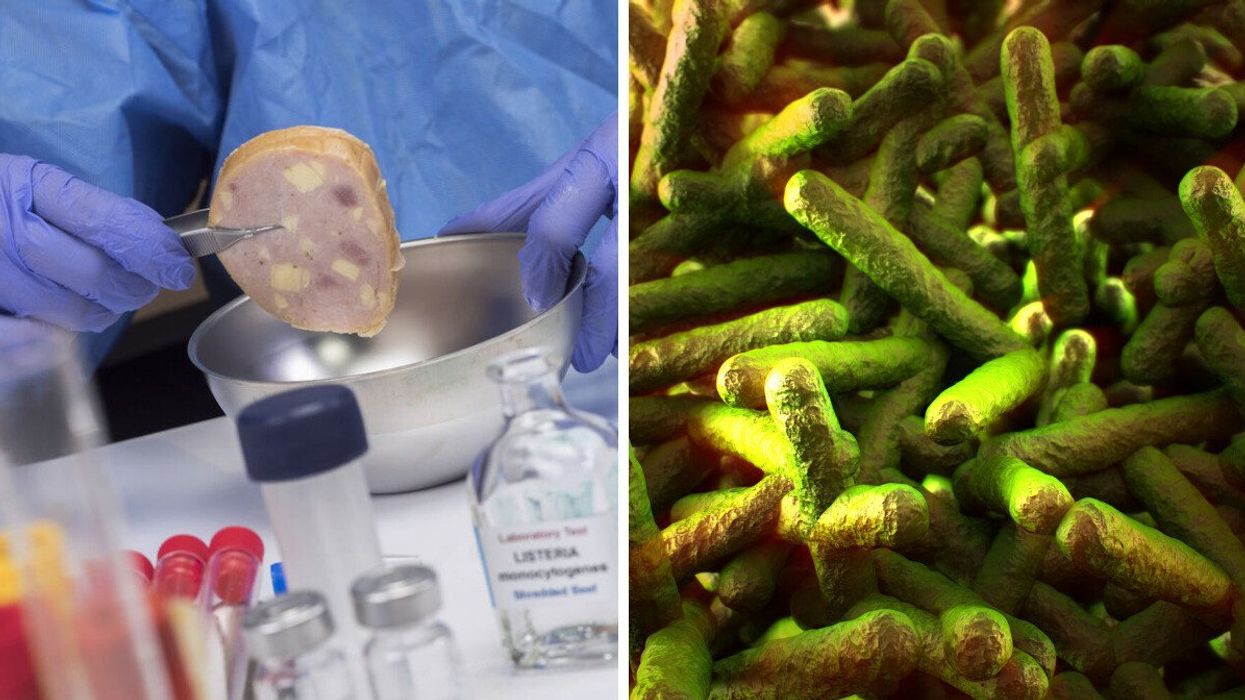 An expert analyzing food contaminated with listeria in a laboratory. Right: Listeria.