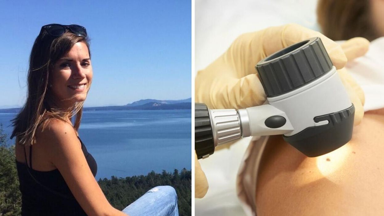 Asymina Kantorowicz. Right: Doctor checking a mole.