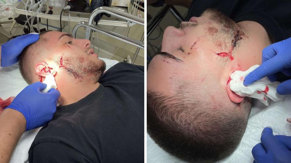 Blessures de William Lepage.