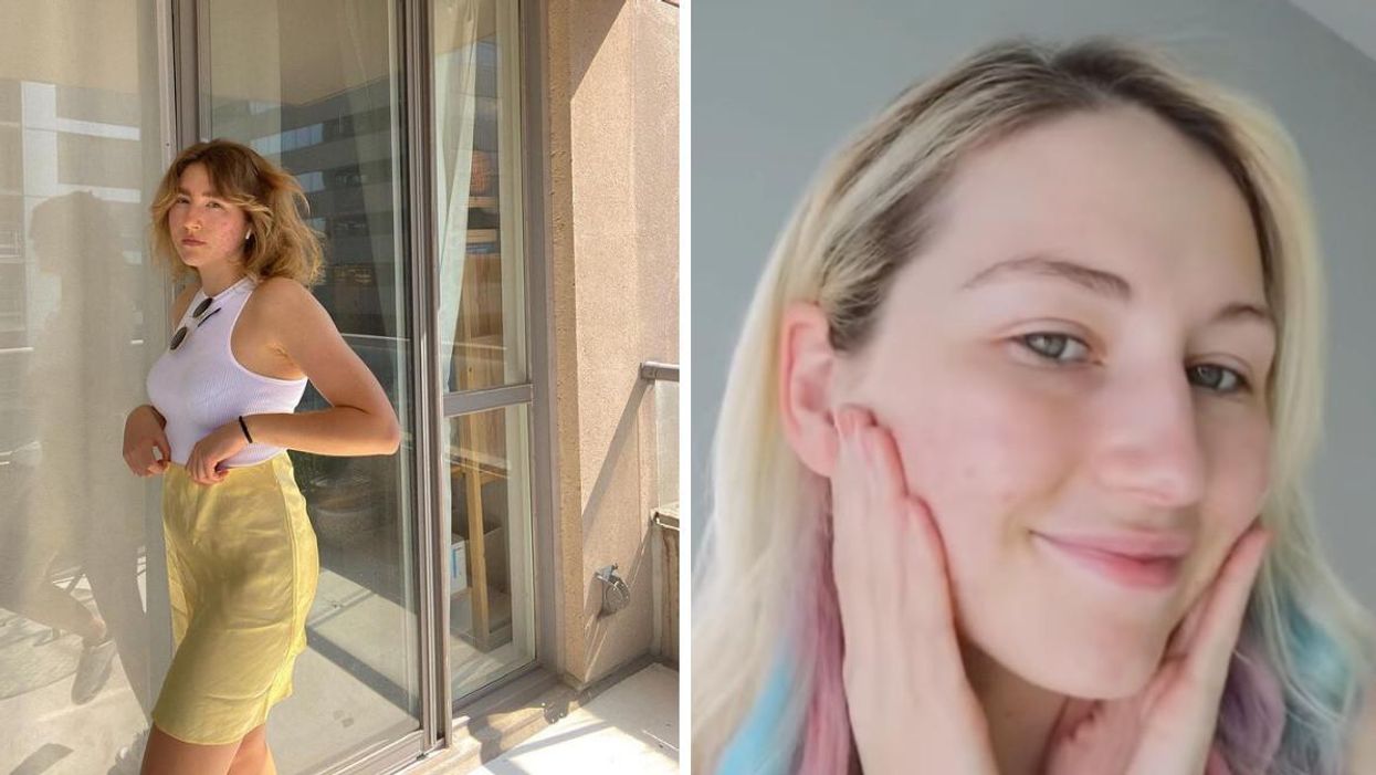 Canadian Skincare Influencers Share Their Struggles With Acne & What They Use To Treat It