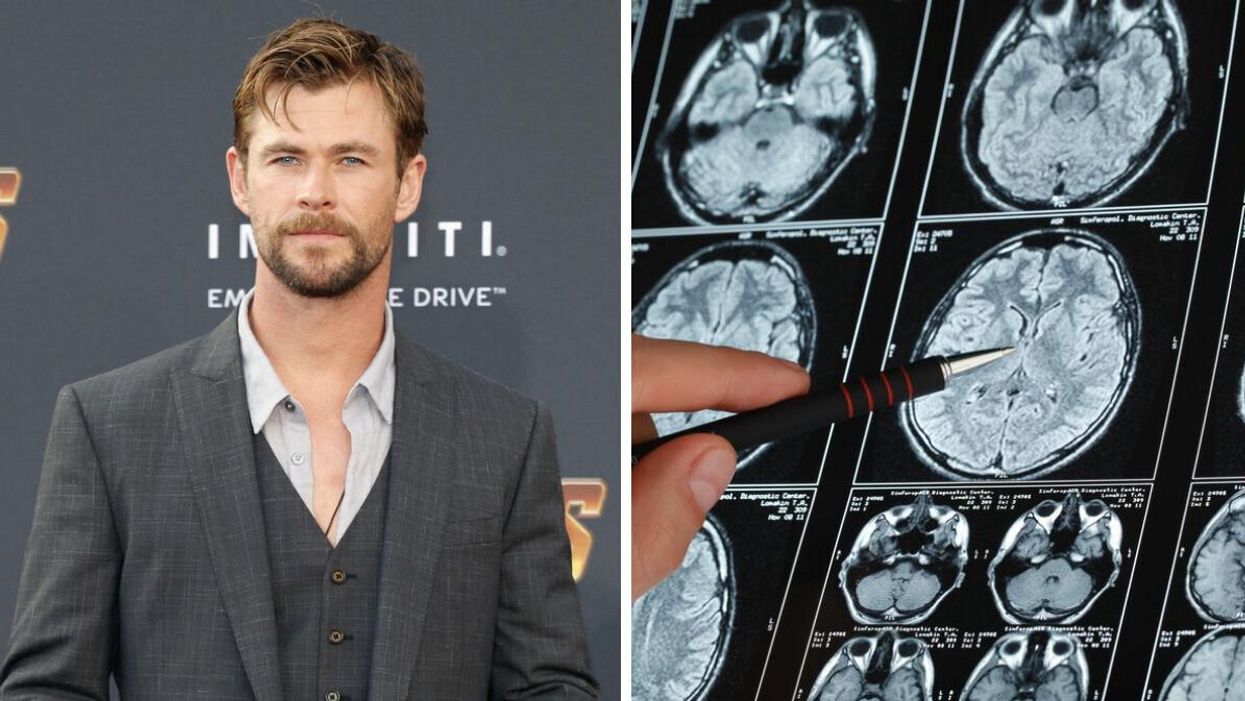 Chris Hemsworth at a movie premiere in 2018. Right: An MRI showing a brain scan.