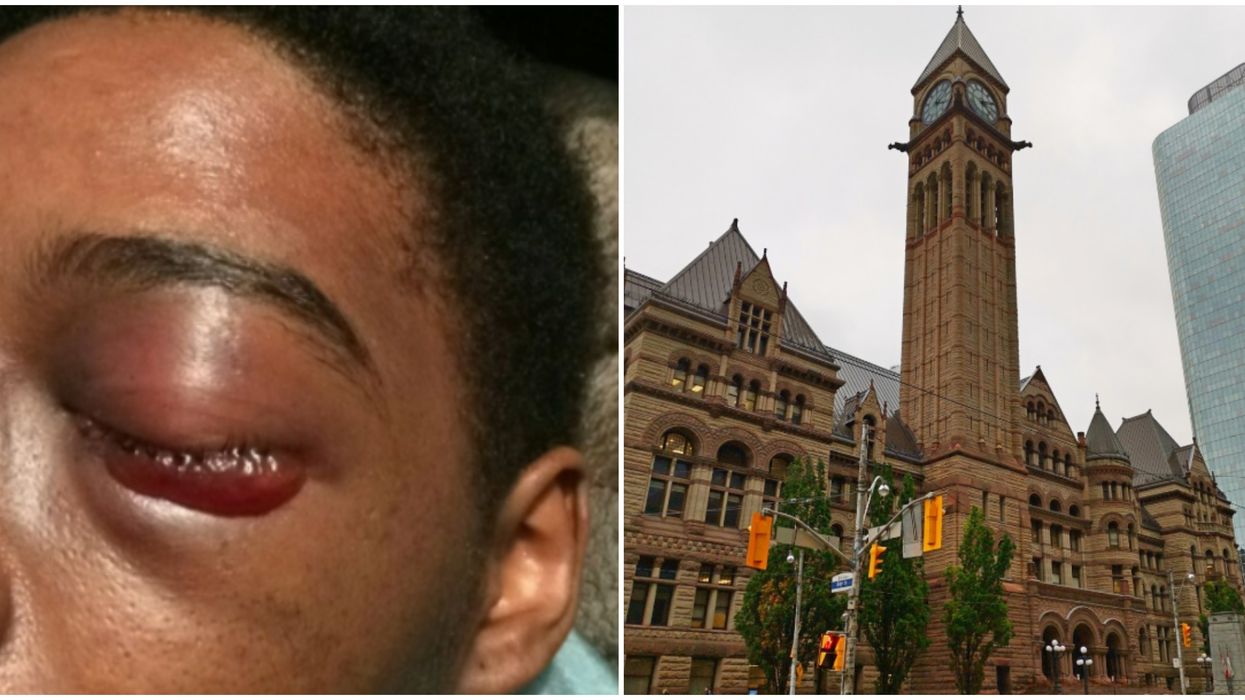 Dafonte Miller Case Ruling Finds Toronto Cop Guilty On Lesser Charge Of Assault