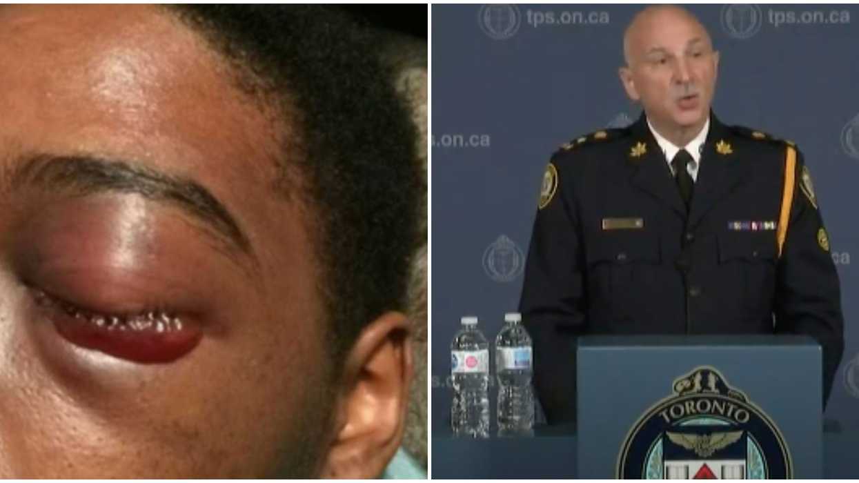 Dafonte Miller Slammed Toronto Police On August 7 By Saying They Are 'Making It Worse'