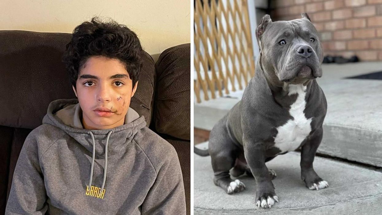 Dog Held By Vaughan Animal Services For Weeks Has Allegedly Bitten A Teenage Boy