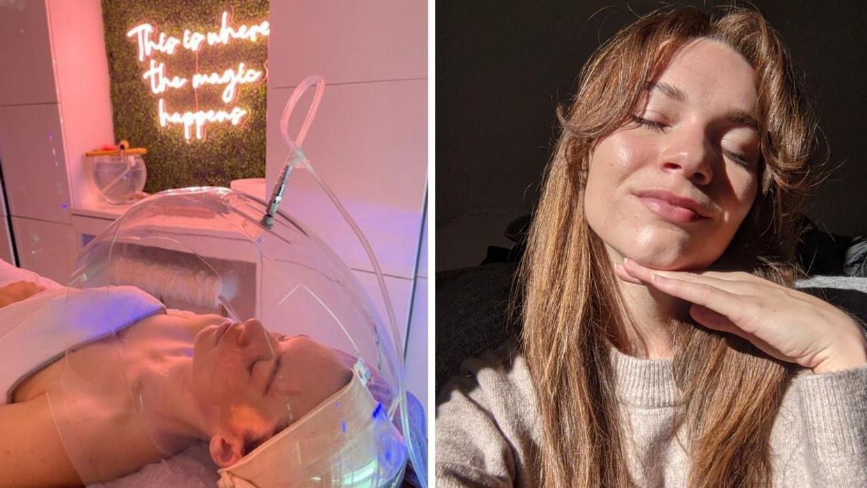 I Tried A Celebrity-Style Facial In Toronto & My Skin Is Glowing