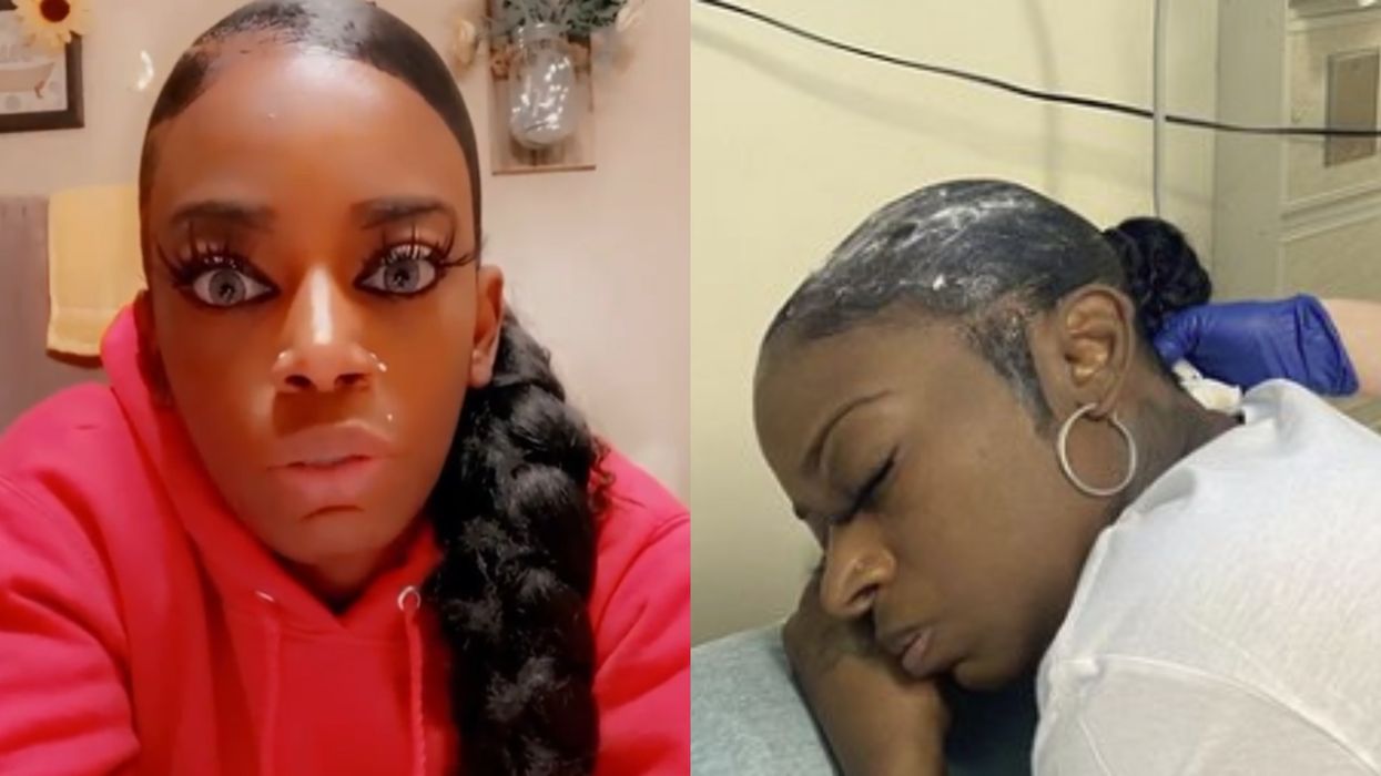 'Gorilla Glue Girl' Might Be Getting Help From A Plastic Surgeon To Fix Her Hair