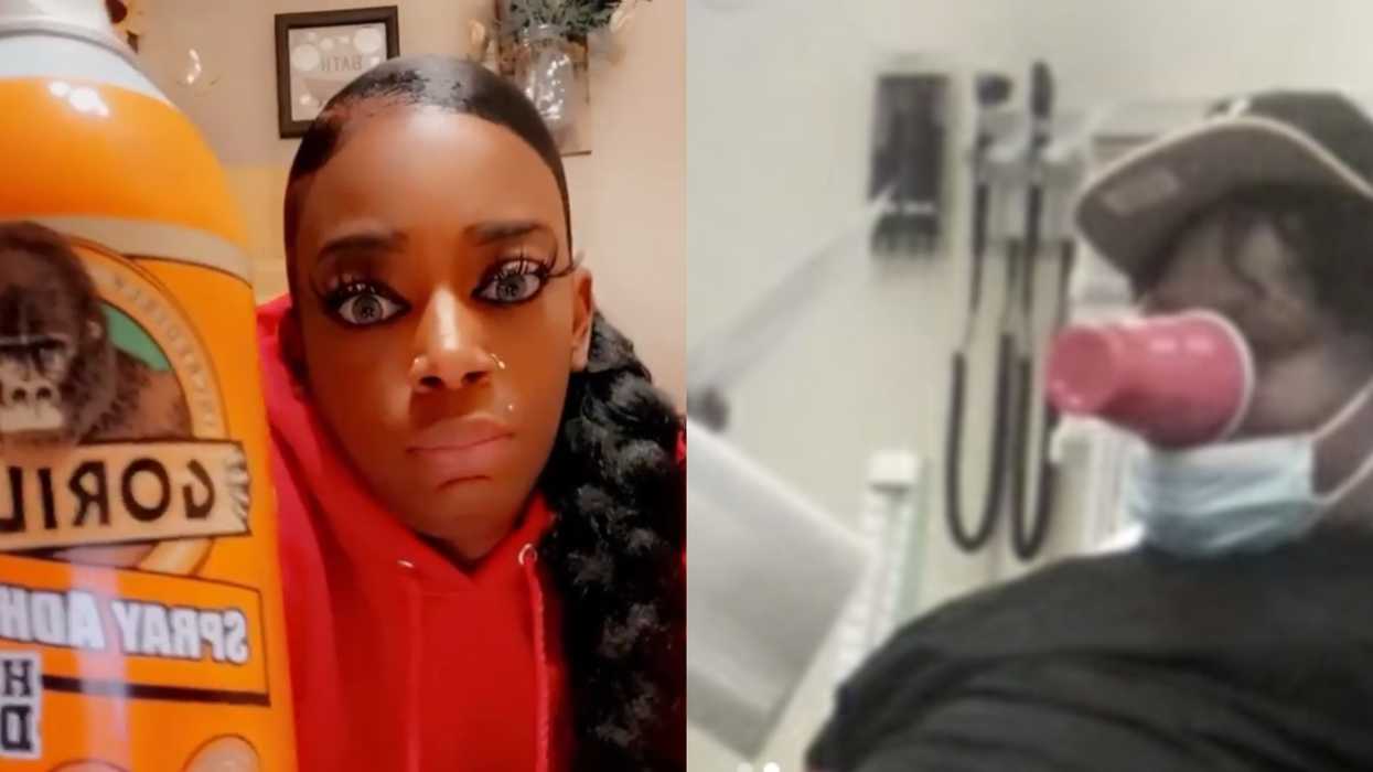 A Louisiana Man Attempted The 'Gorilla Glue Challenge' & It Went Very Wrong (VIDEO)