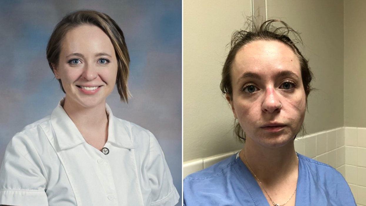 A COVID Nurse Shares Before & After Photos Depicting The Toll Months Of Working Has Taken
