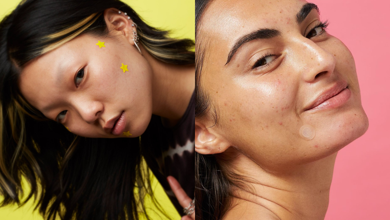 6 Game-Changing Pimple Patches That Work Just As Good As The Cosrx Ones