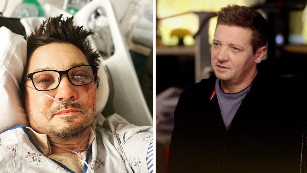 Jeremy Renner after his snowplow accident. Right: Jeremy Renner during his ABC interview.
