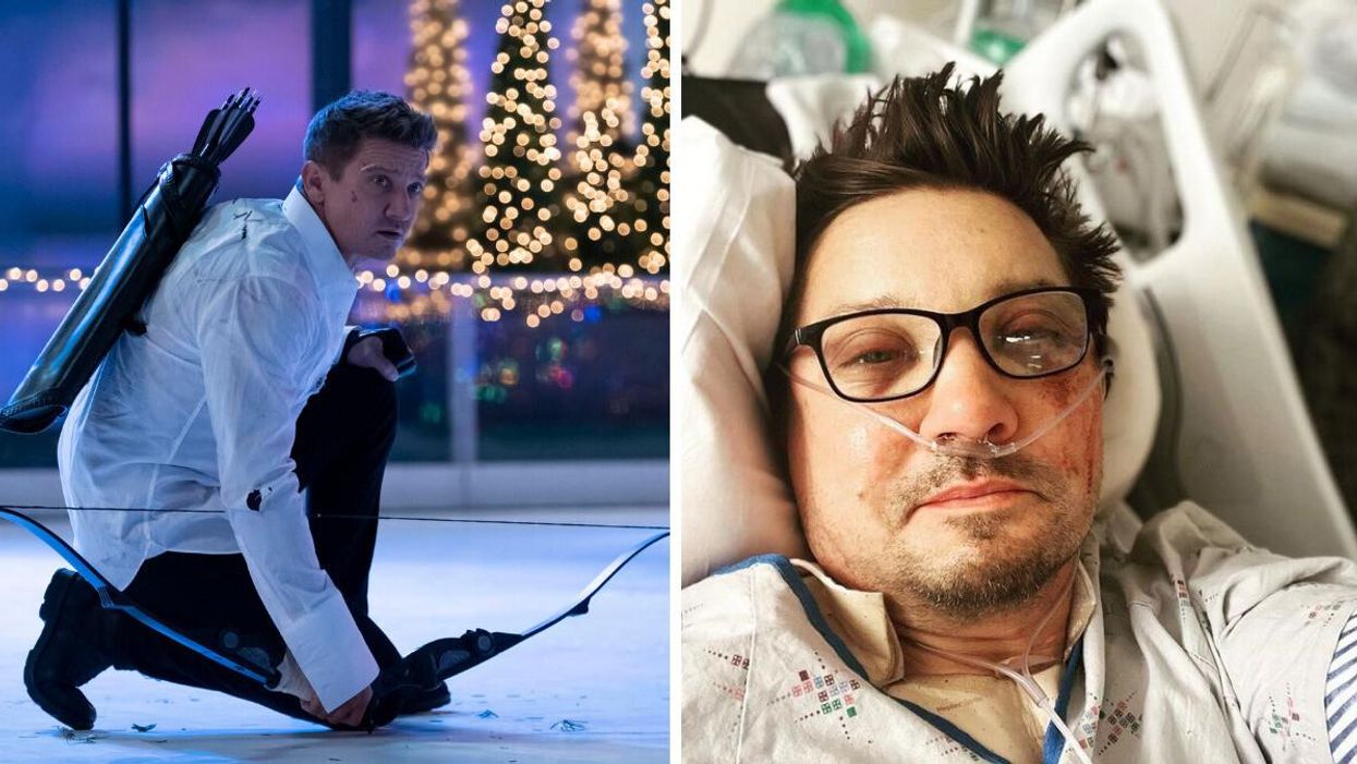 Jeremy Renner as Clint Barton in "Hawkeye" on Disney+. Right: Jeremy Renner after his snowplow accident.