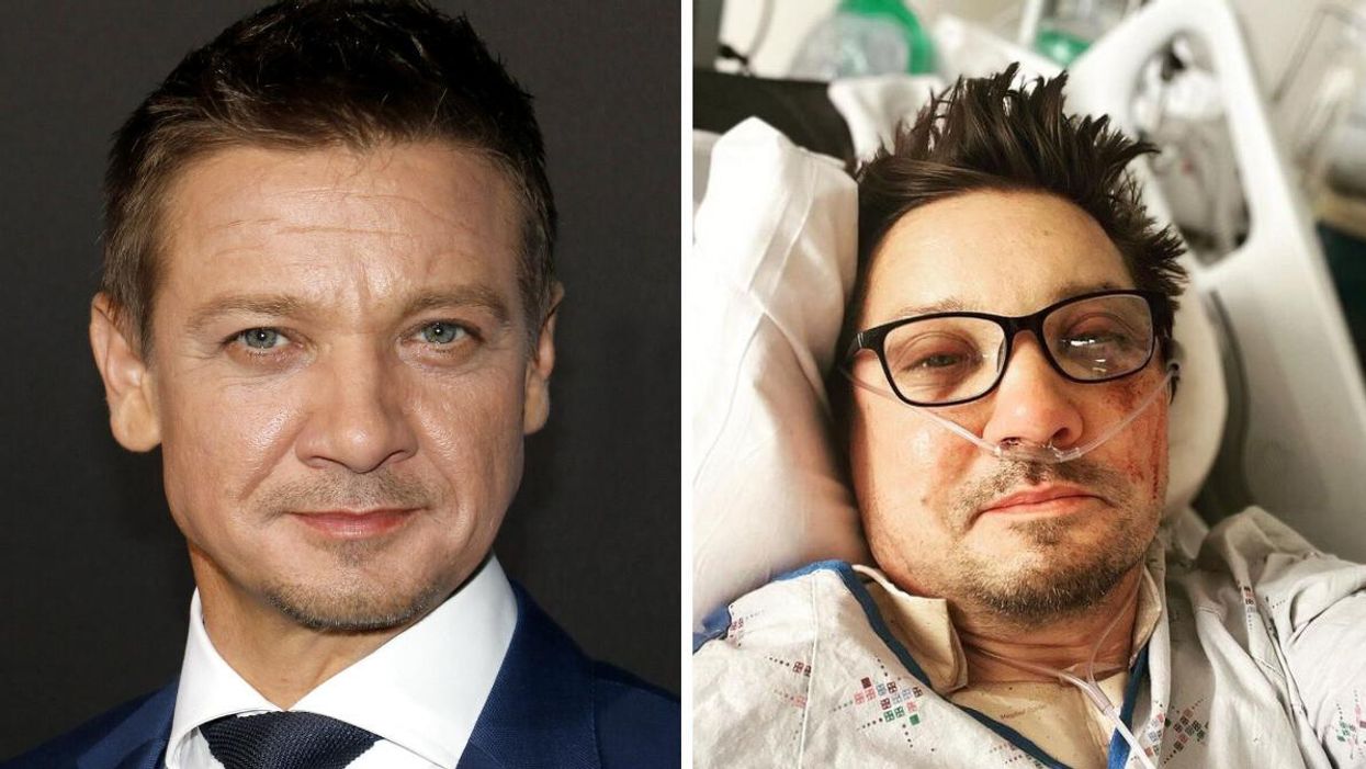 Jeremy Renner at the 2016 "Arrival" premiere in LA. Right: Jeremy Renner in hospital following his snowplow accident.