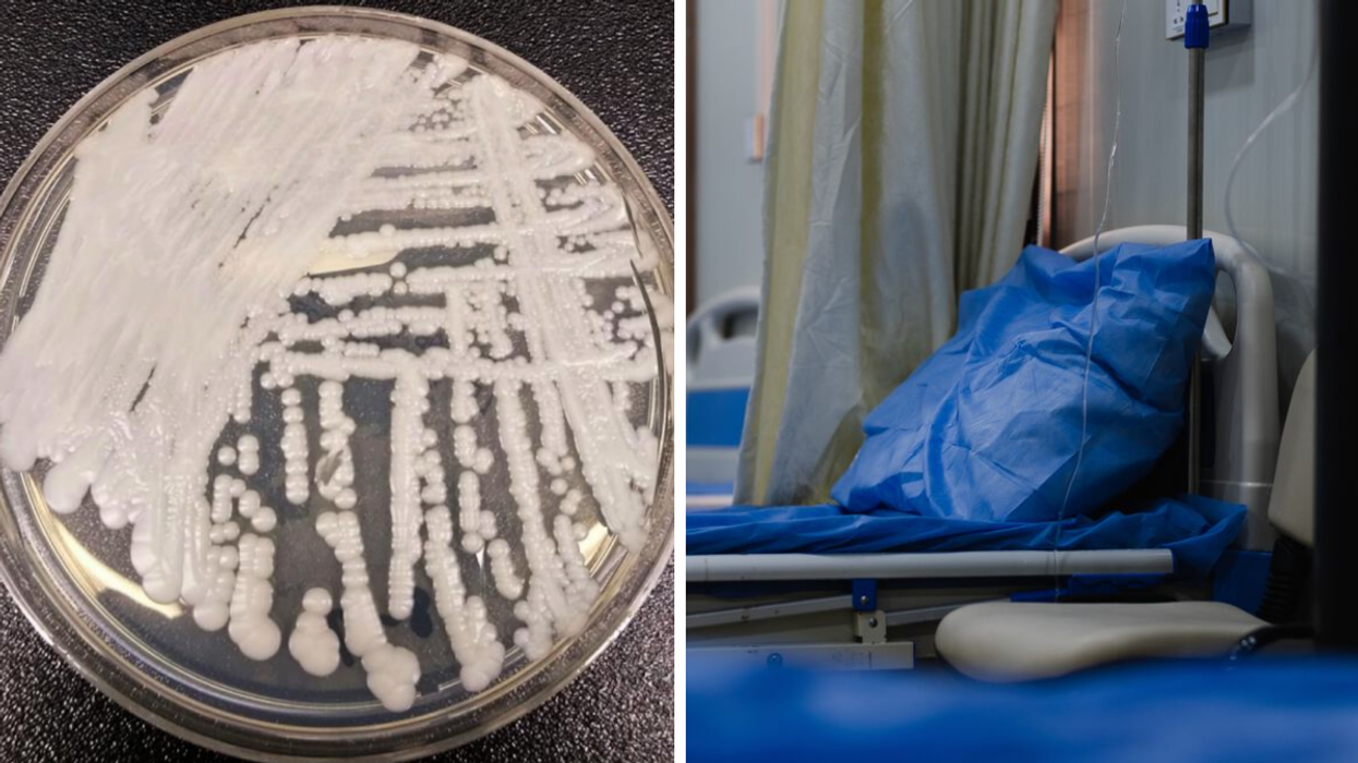 Le champignon Candida auris. Droite : Lit d'hôpital.