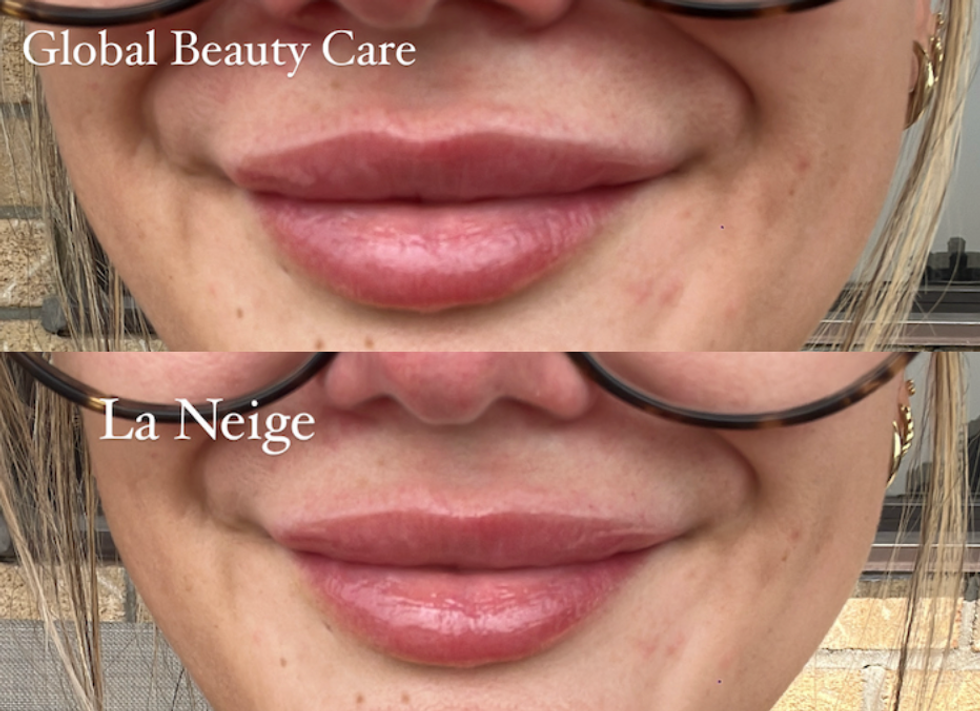 Les l\u00e8vres d'Izabelle qui porte chaque formule.