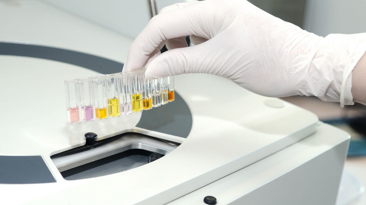 Medical samples being tested.