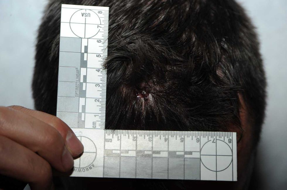 Myles Gray exhibits tell story of his death