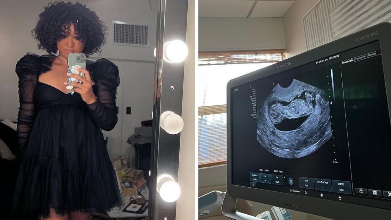 Naomi Osaka. Right: Naomi Osaka's pregnancy ultrasound.