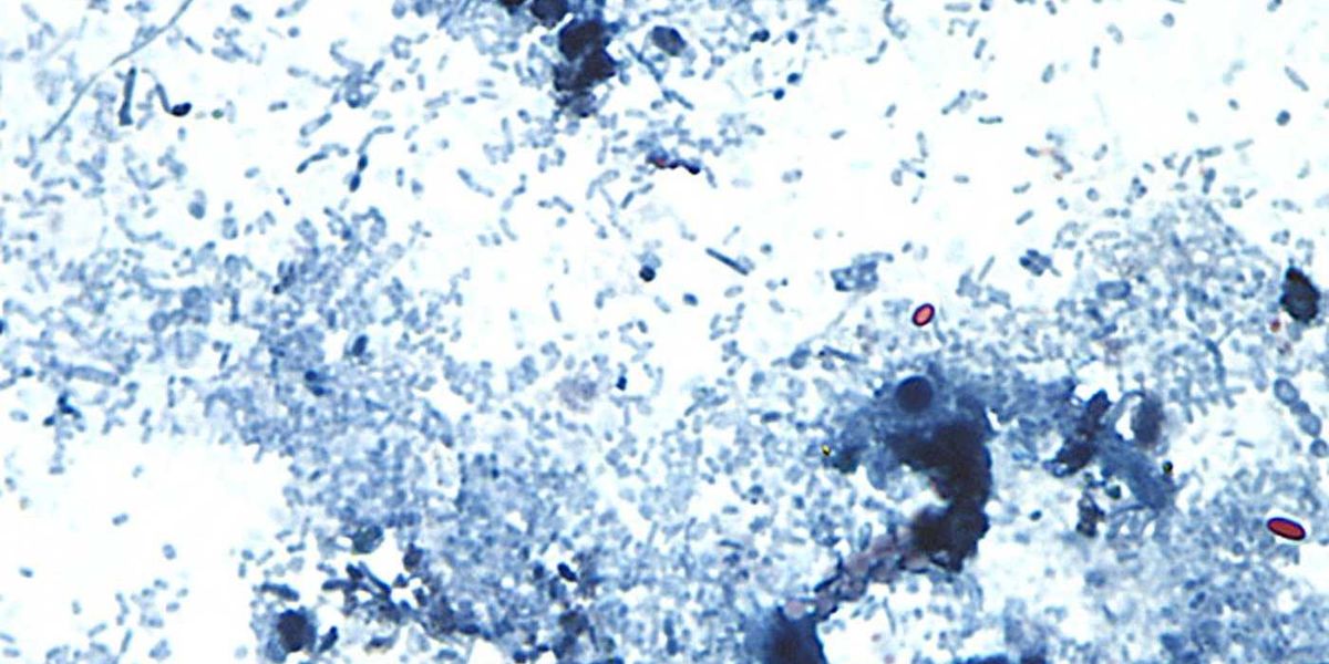 No cyclospora outbreaks reported or tainted lettuce sold in Canada, officials say No cyclospora outbreaks reported or tainted lettuce sold in Canada, officials say