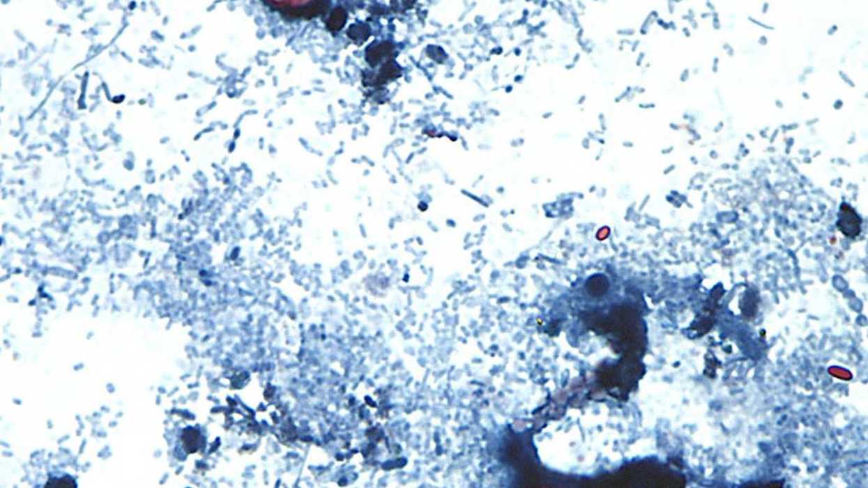 No cyclospora outbreaks in Canada: health agency