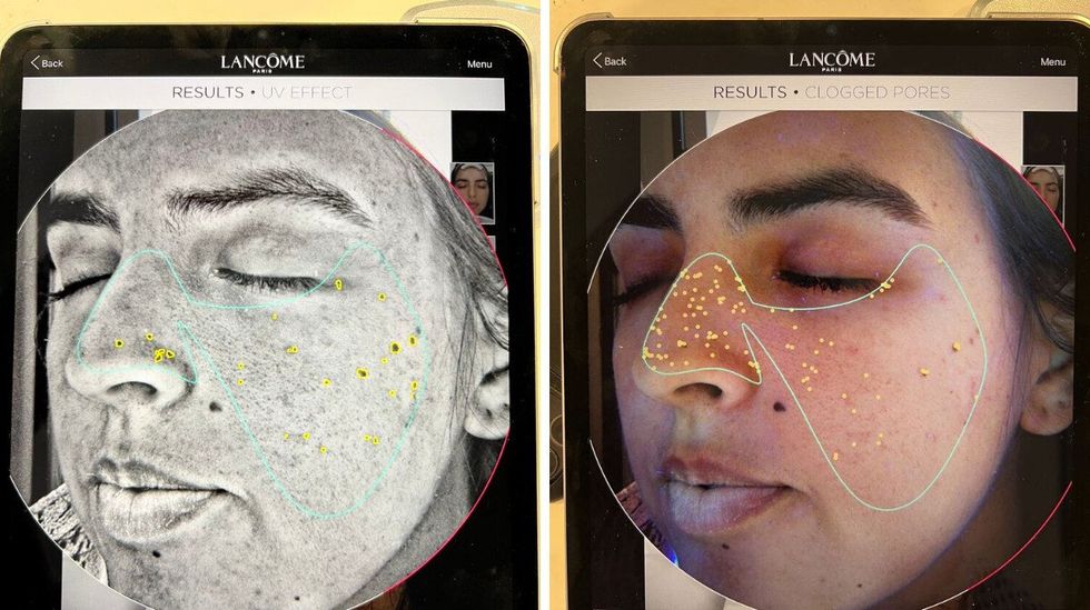 Paige McPhee's Skin Screen results.