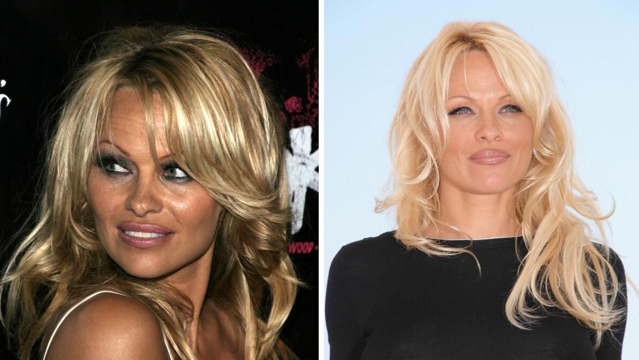 Pamela Anderson.