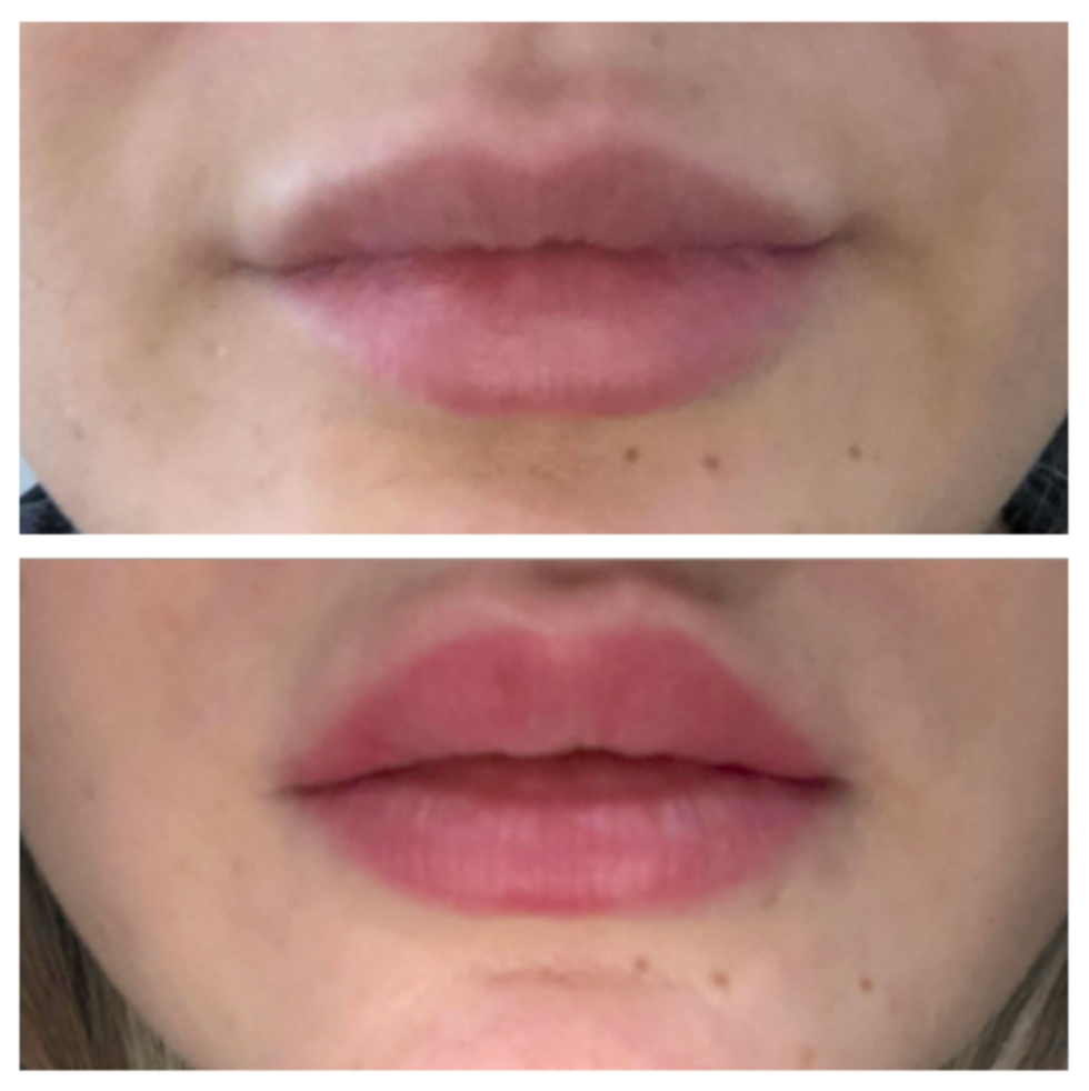 Photos du Lip Blush avant/apr\u00e8s.