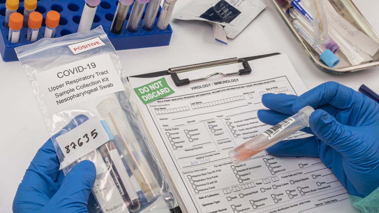 Public Health Ontario Finds Over 100 COVID-19 Variant Cases In A Single-Day Test