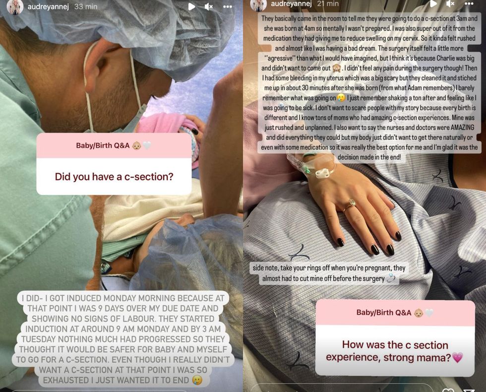 Questions et r\u00e9ponses sur l'accouchement.