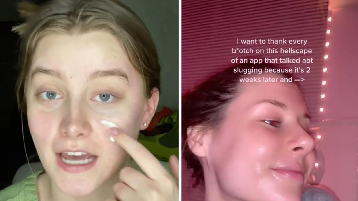'Slugging' Is TikTok's Latest Beauty Trend & It's Helping Vaseline Make A Comeback
