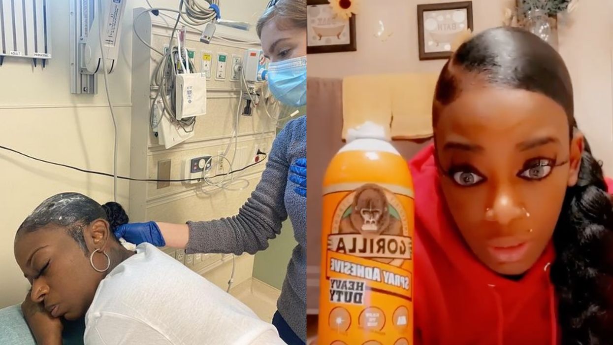 Tessica Brown Gorilla Glue Girl Surgery Treatment Dr. Michael Obeng