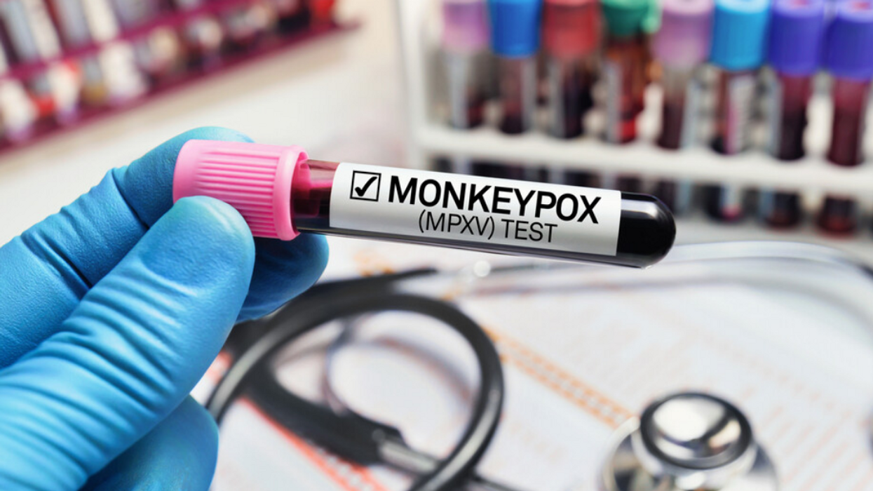 Test pour la variole du singe.