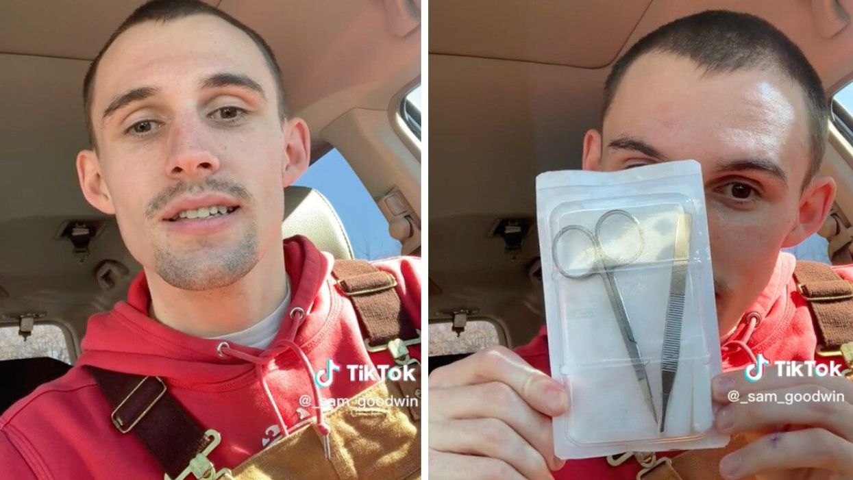 The TikToker in his viral video. RIght: The TikToker holding a kit he was given to get his stitches removed.