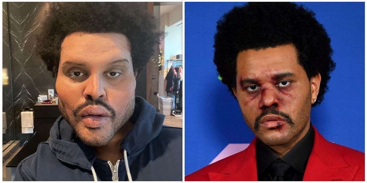 What Is Going On With The Weeknd's Face? - Narcity