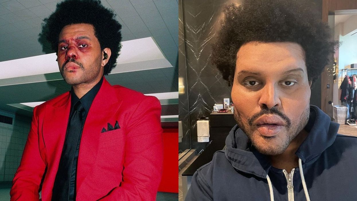 The Weeknd Super Bowl Halftime Face Bandages