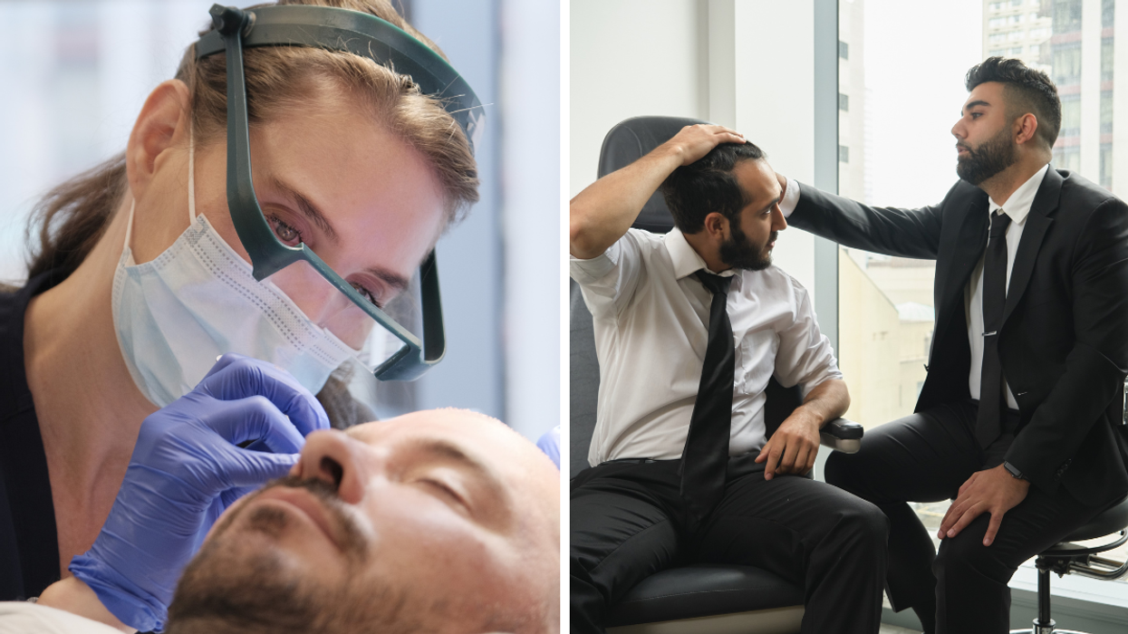 Thousands of Canadians are turning to this Toronto clinic for hair transplants