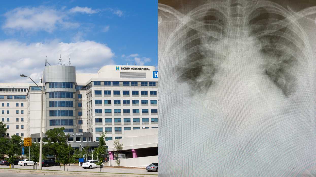 Toronto Doctor Shows What COVID-19 Can Look Like In Young People