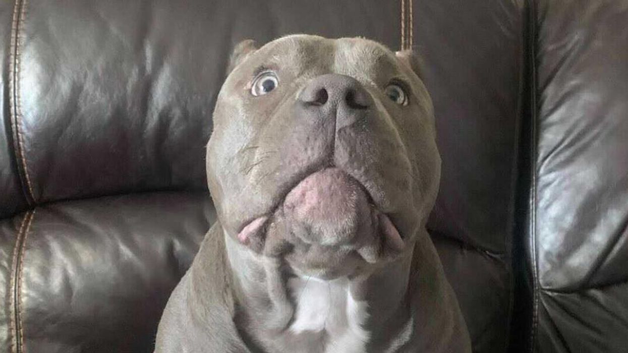 Toronto Owners Of Dog Who Attacked Teen Say They Are Getting 'Death Threats'