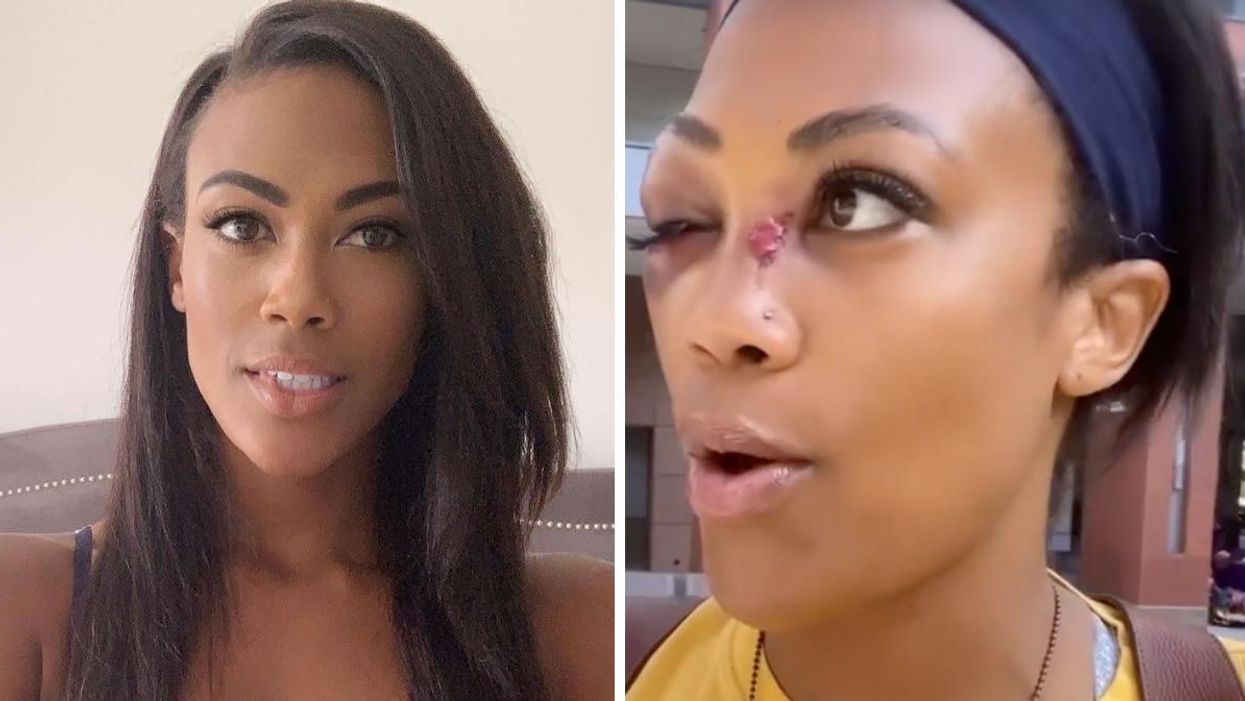 U.S. Olympian Kim Glass. Right: Glass after she was attacked in Los Angeles.