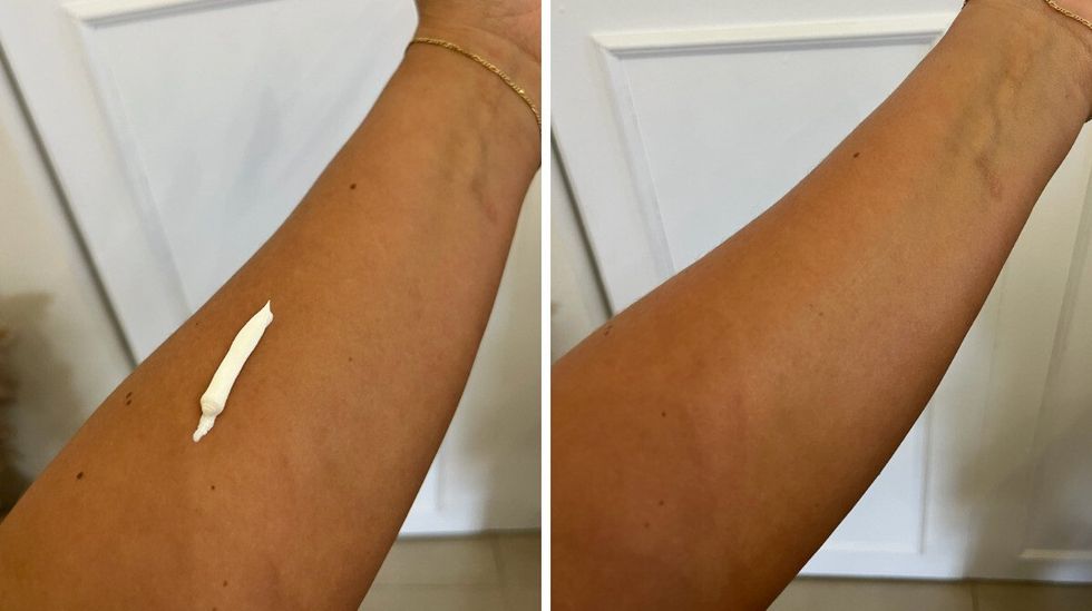 Un bras avec de la cr\u00e8me solaire. Droite : un bras.