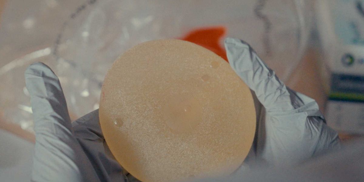 Un registre des implants mammaires réclamé au Canada - Voici pourquoi
