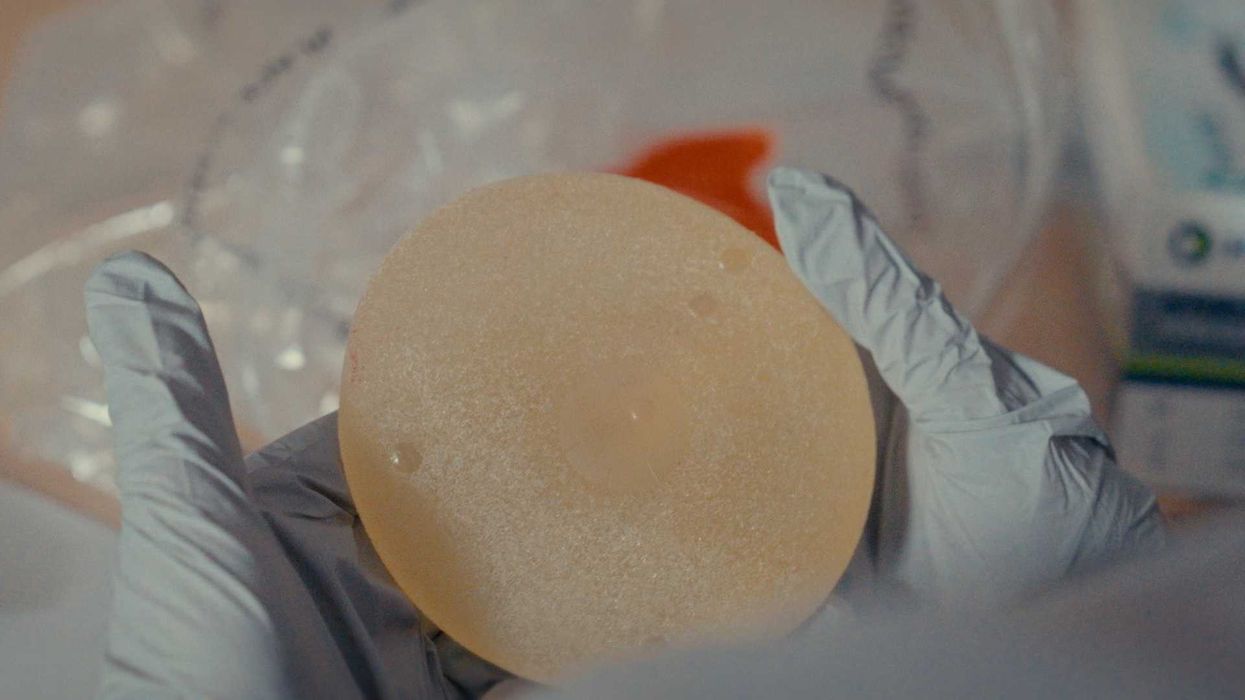 Un implant mammaire.