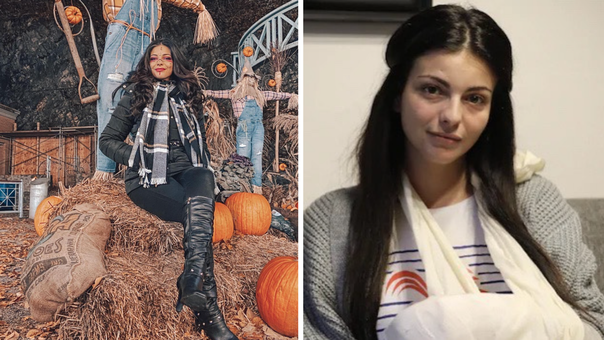 Une des victimes de l'attaque au sabre à Québec revient sur ces blessures un an plus tard